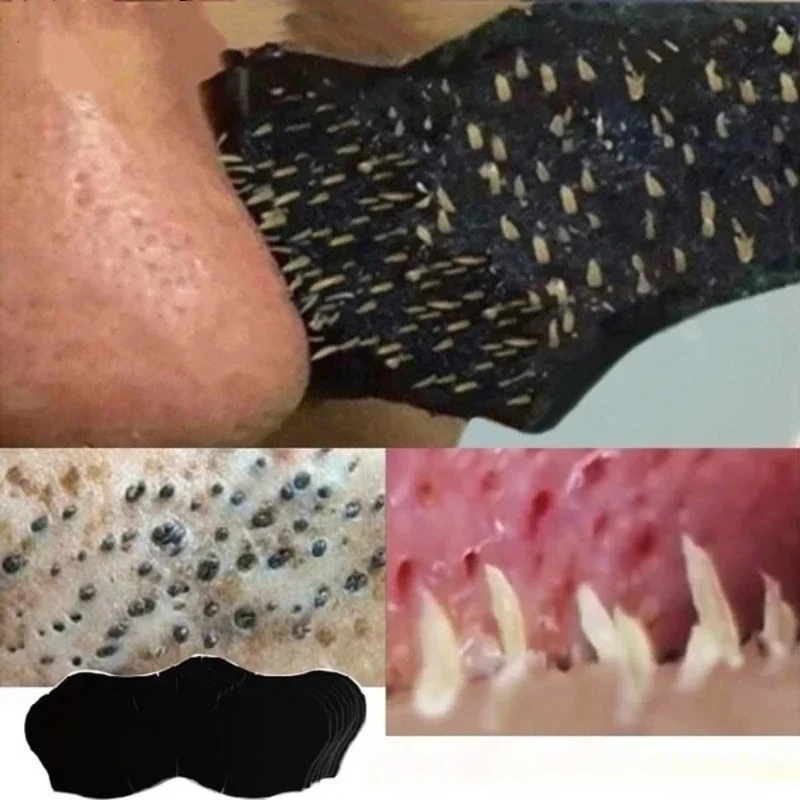 Charcoal Pore Strip - Mascarilla para eliminar espinillas Unisex, tiras