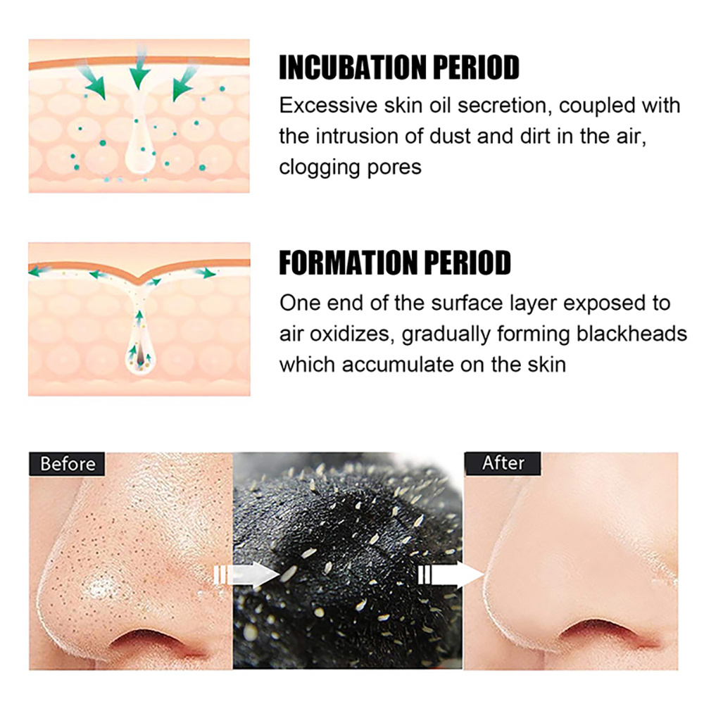 Mascarilla eliminadora de espi - Charcoal Pore Strip reseña y precio
