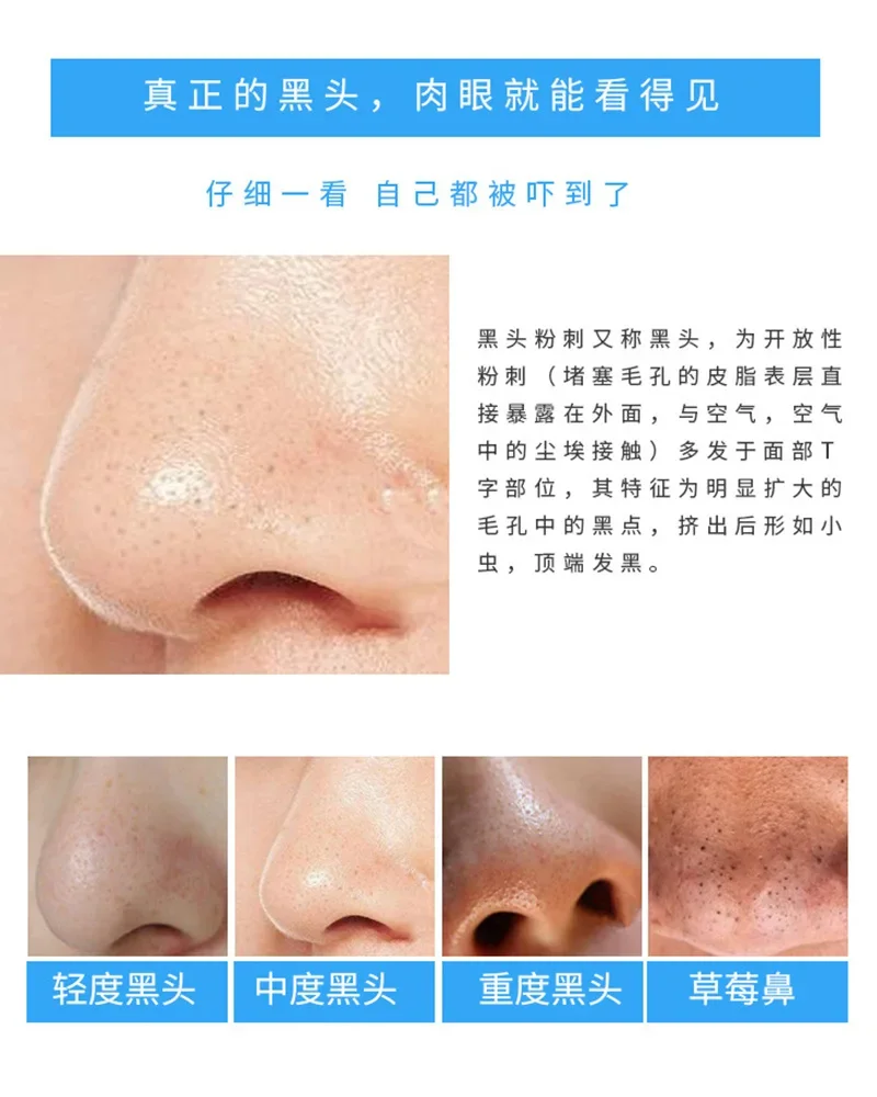 30 tiras de carbón de bambú pa - Charcoal Pore Strip reseña y precio
