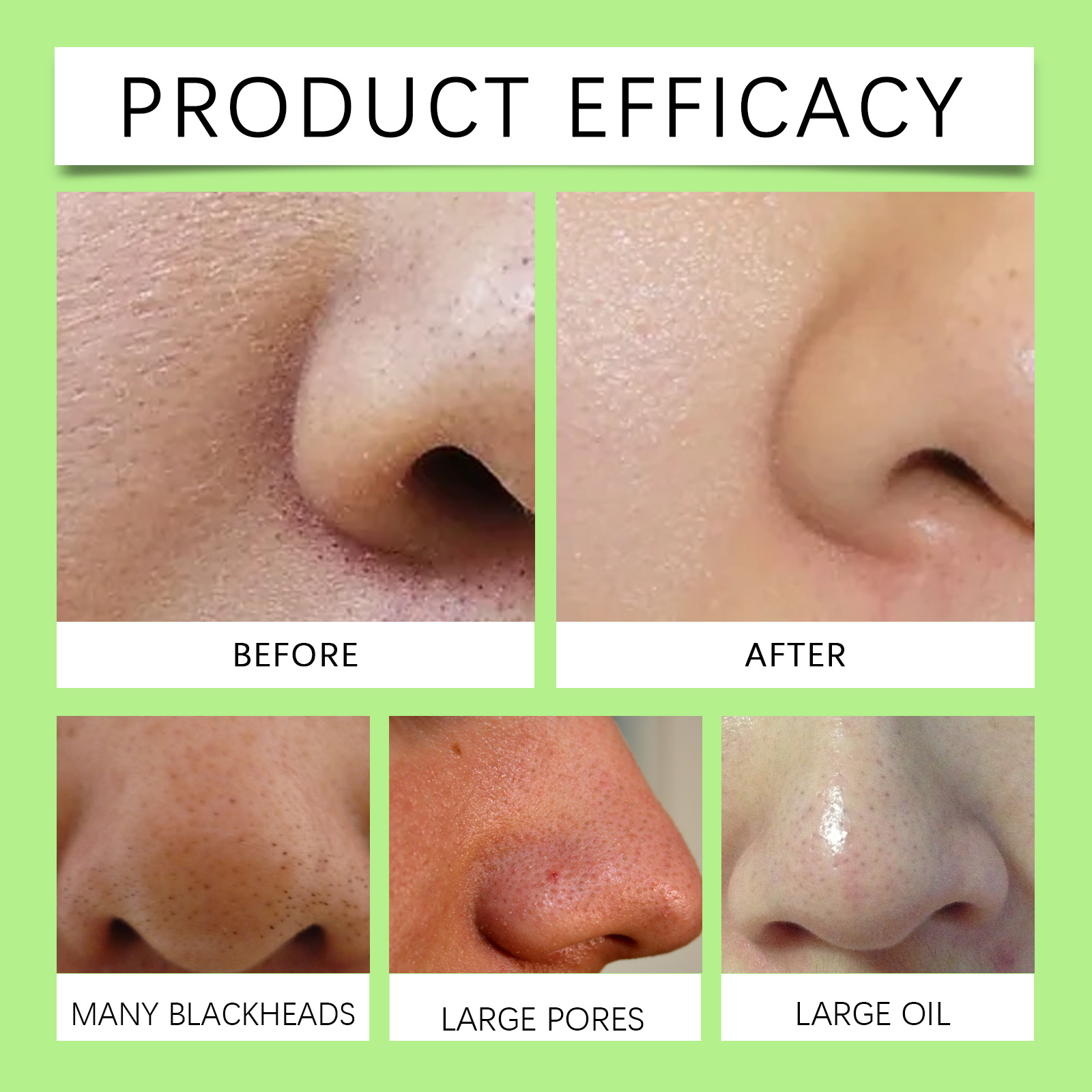 Tiras Nasales de Carbón de Bam - Charcoal Pore Strip reseña y precio