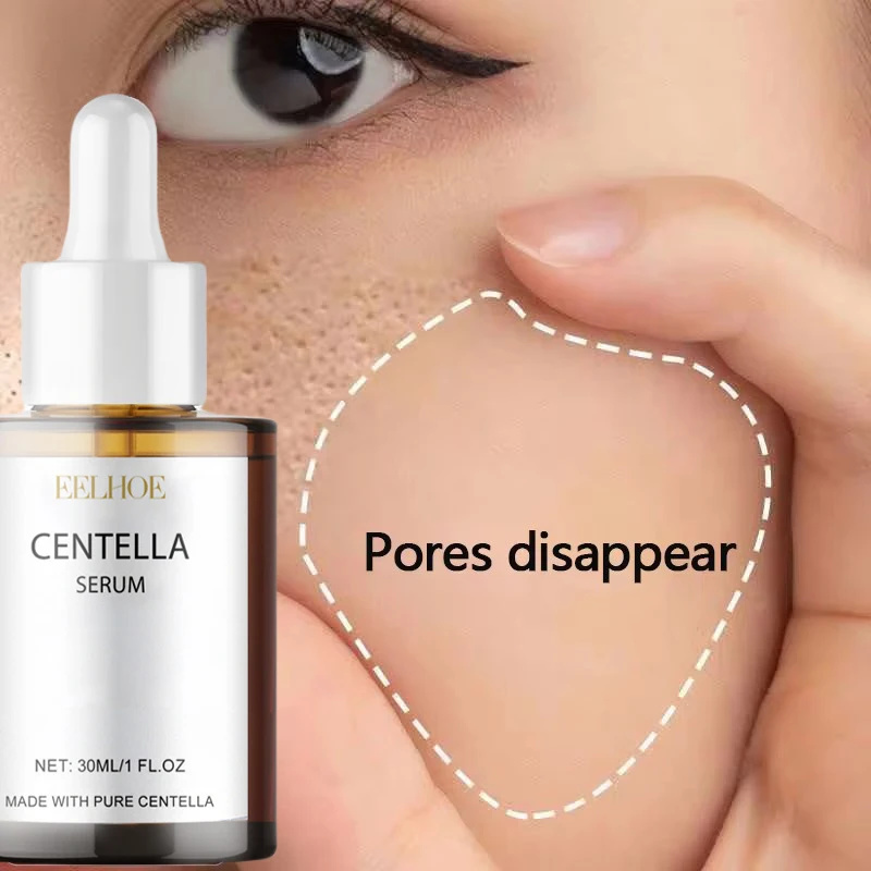 Centella Asiatica suero Facial - Snail Mucin Essence reseña y precio
