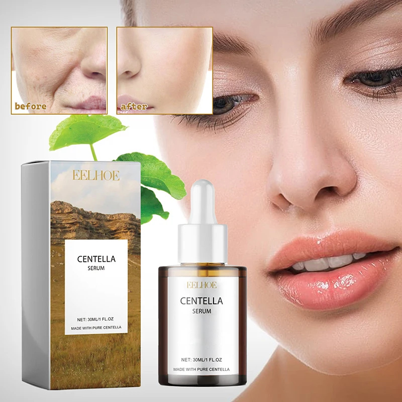 Centella Asiatica suero Facial - Snail Mucin Essence reseña y precio