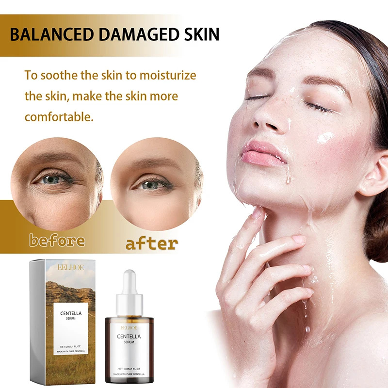 Centella Asiatica suero Facial - Snail Mucin Essence reseña y precio